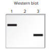Chapter 21 describes a blotting method known as Western blotting that can be used to detect the production of a polypeptide that is translated from a particular mRNA. In this method, a protein is detected with an antibody that specifically recognizes and binds to the protein’s amino acid sequence. The antibody acts as a probe to detect the presence of the protein. In a Western blotting experiment, gel electrophoresis is used to separate a mixture of proteins according to their molecular masses. After the antibody has bound to the protein of interest within a blot of a gel, the protein is visualized as a dark band. For example, an antibody that recognizes the β-globin polypeptide could be used to specifically detect the β-globin polypeptide in a blot. As shown here, the method of Western blotting can be used to determine the amount and relative size of a particular protein that is produced in a given cell type.
Lane 1 is a sample of proteins isolated from normal red blood cells.
Lane 2 is a sample of proteins isolated from kidney cells. Kidney cells do not produce the β-globin polypeptide.
Lane 3 is a sample of proteins isolated from red blood cells from a patient with β-thalassemia. This patient is homozygous for a mutation that results in the shortening of the β-globin polypeptide.
Now here is the question. A protein called troponin contains 334 amino acids. Because each amino acid weighs 120 daltons (Da) (on average), the molecular mass of this protein is about 40,000 Da, or 40 kDa. Troponin functions in muscle cells, and it is not expressed in nerve cells. Draw the expected results of a Western blot for the following samples:
Lane 1: Proteins isolated from muscle cells
Lane 2: Proteins isolated from nerve cells
Lane 3: Proteins isolated from the muscle cells of an individual who is homozygous for a mutation that introduces a stop codon at codon 177 in the gene that encodes troponin