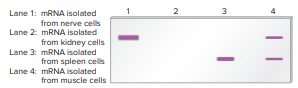 The method of Northern blotting is used to determine the amount and size of a particular RNA transcribed in a given cell type. Alternative splicing (discussed in Chapter 12) produces mRNAs of different lengths from the same gene. The Northern blot shown here was made using a DNA probe that is complementary to the mRNA encoded by a particular gene. The mRNA in lanes 1 through 4 was isolated from different cell types, and equal amounts of total cellular mRNA were added to each lane
Explain these results.